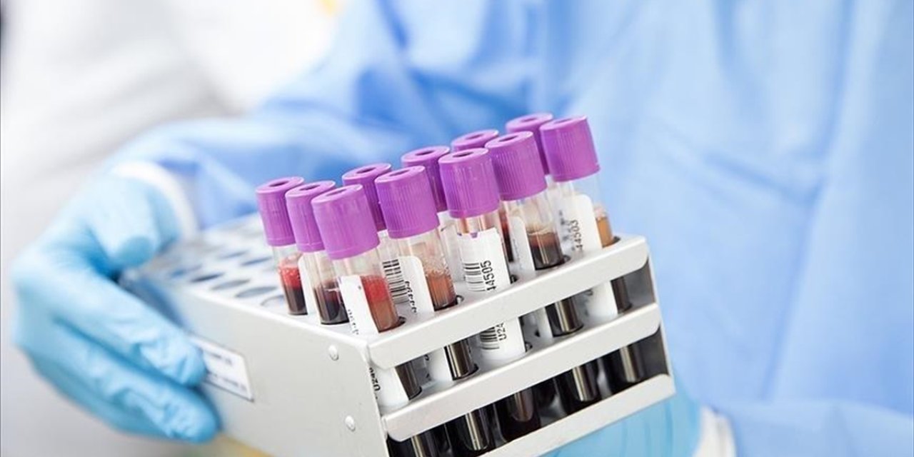 Maymun çiçeğinin yayılımını önlemek için erken teşhis ve izolasyon önemli