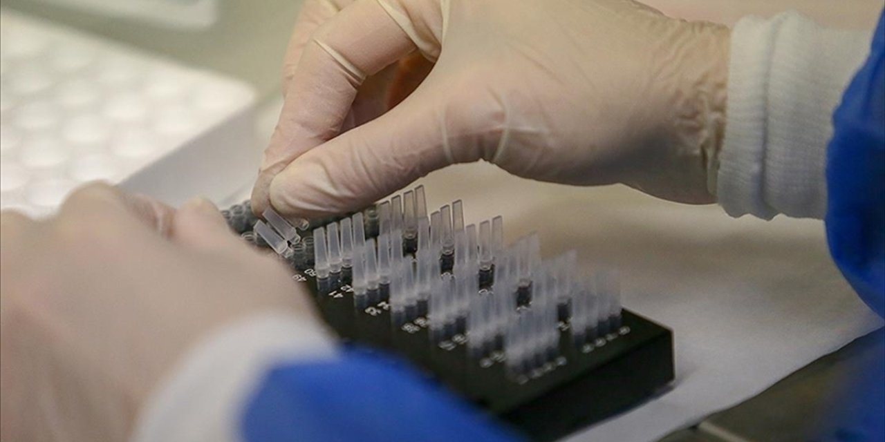 Gizemli hepatit vakalarına 'adeno-ilişkili virüsün' neden olduğu öne sürüldü