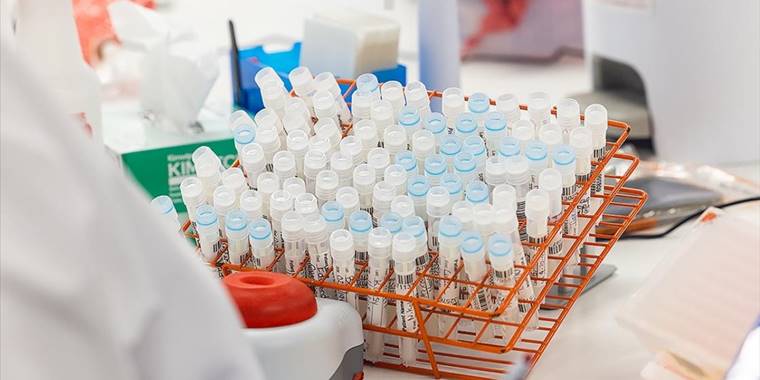 Brezilya'da maymun çiçeği vakaları nedeniyle maymunlara saldırılar artıyor