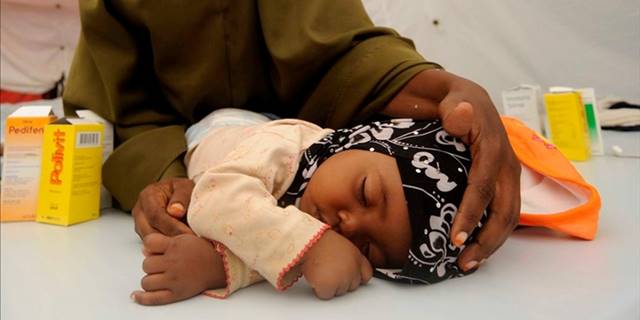 Zimbabve'de 157 çocuk kızamık salgınında hayatını kaybetti