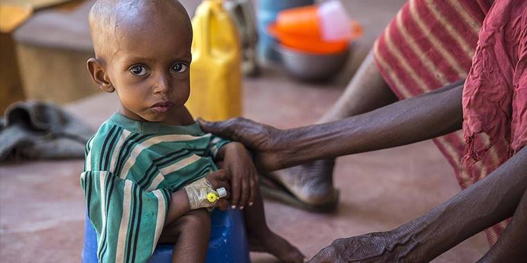 Somali'de gıda sıkıntısı 500 bin çocuğu ölüm riskiyle karşı karşıya bırakıyor