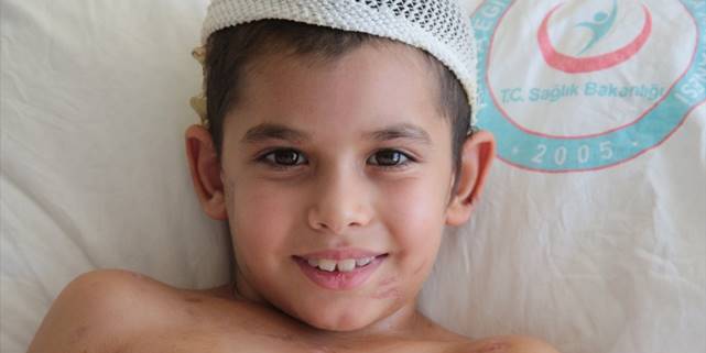 Sahipsiz köpeklerin saldırdığı küçük Umut 24 gün sonra taburcu edildi