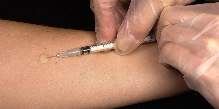 Kuduzda "aşı" ve "koruyucu tedbirler" hayat kurtarıyor