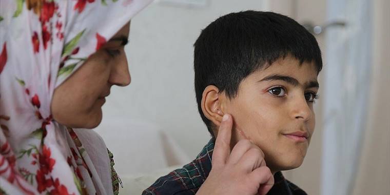 Mardin'de 9 ay önce uğradığı köpek saldırısının izini halen yüzünde taşıyor