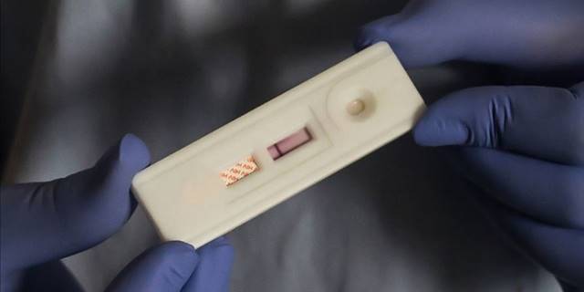 Resmi kayıtlara göre Türkiye'de 32 bin 376 kişi HIV ile yaşıyor