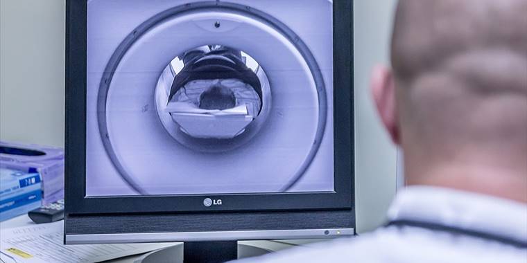 Bilim insanları yaygın görülen bir beyin tümörünün 3 alt türünü tespit etti