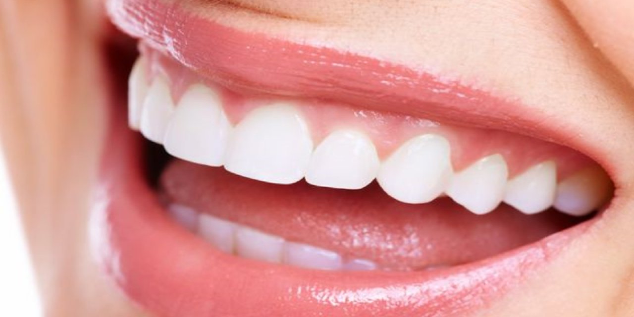 Diş Törpüleme Diş Apsesi Kompozit Dolgu