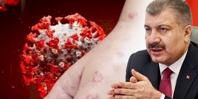 Eris varyantı Türkiye'de