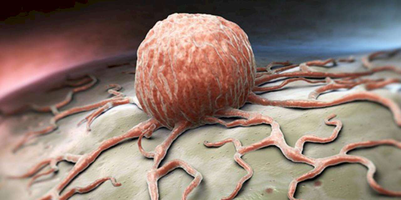 Kanser görülme sıklığı 50 yaşın altına indi!