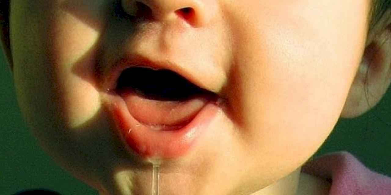 Çocuklarda salyanın nedeni geniz eti büyümesi!