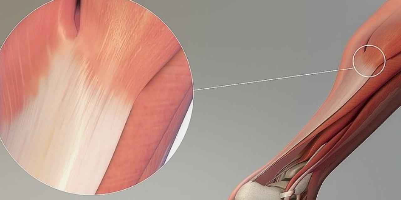 Yaz sıcağında bu spor sakatlanmasına dikkat!