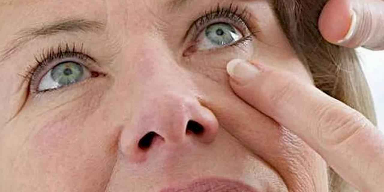Göz kapağı hastalıklarına dikkat!