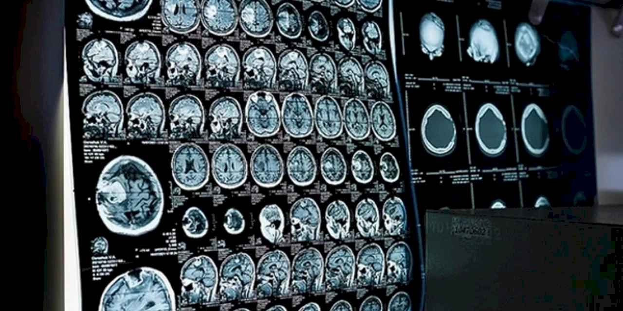 Ücretsiz kanser taramaları için SMS ile bilgilendirme dönemi