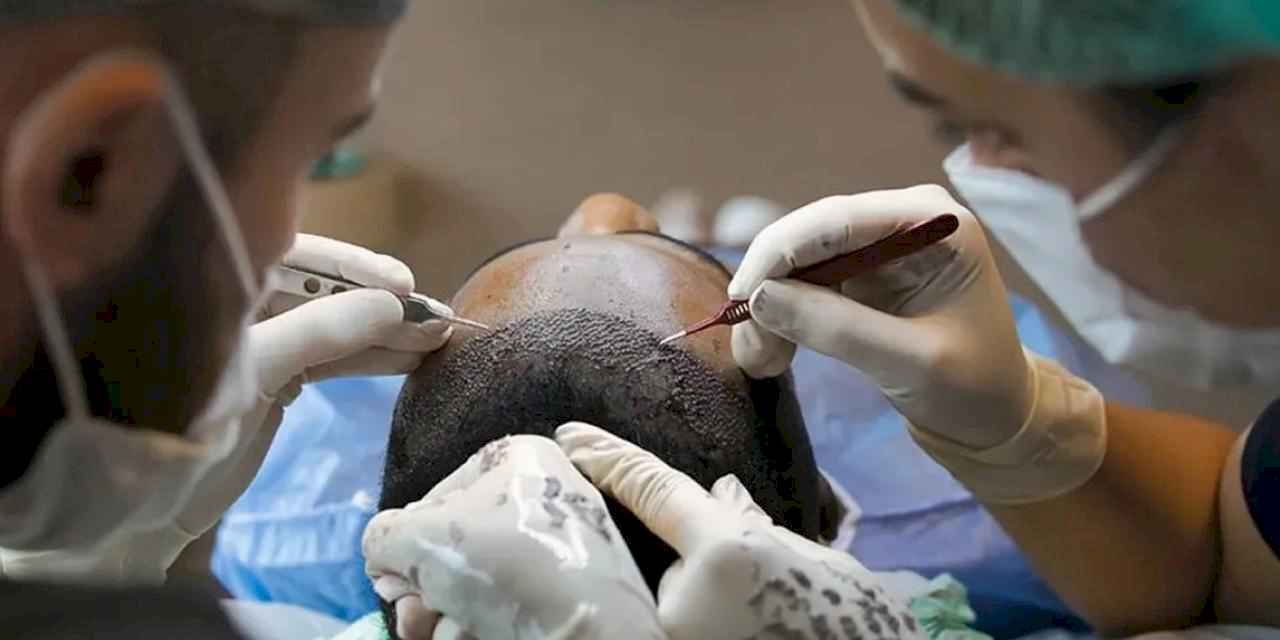 Sağlık Bakanlığı’ndan saç ekimi birimlerinde yeni dönem