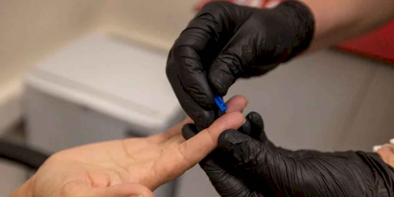 İzmir Büyükşehir'den kimliksiz ve ücretsiz test hizmeti