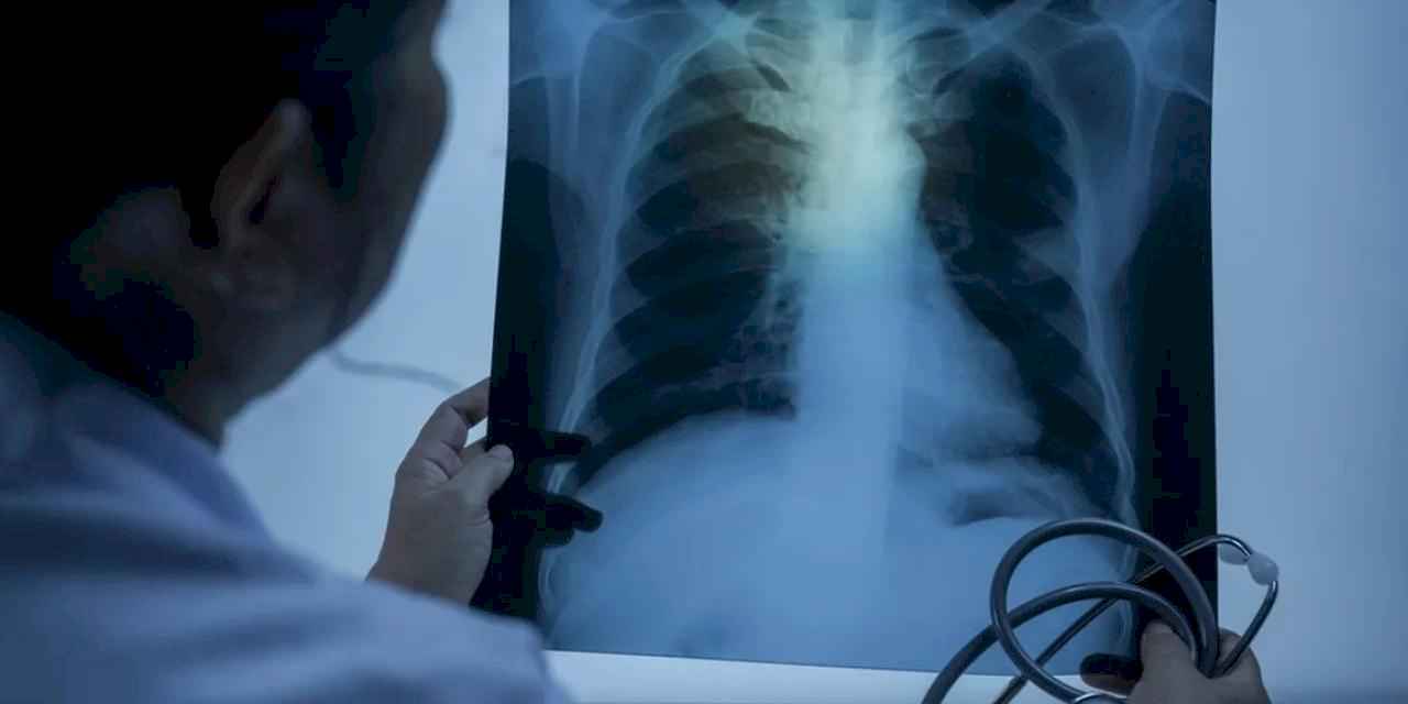 Uzm. Dr. Kılıçlı: Zatürre toplum sağlığı için büyük tehdit