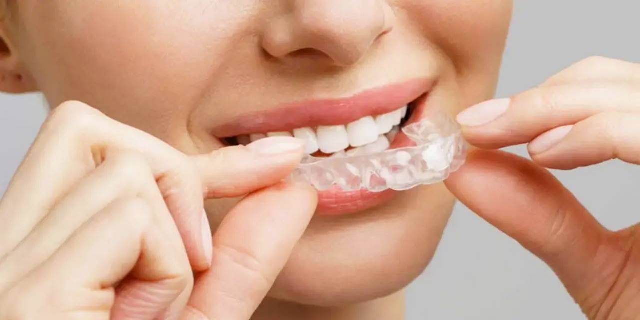 Diş Teli Taktırmadan Dişleri Düzeltmenin En Konforlu Yolu