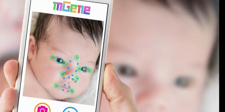 Yapay Zekâ, Nadir Hastalıklarla Mücadeleyi Yeniden Şekillendiriyor   