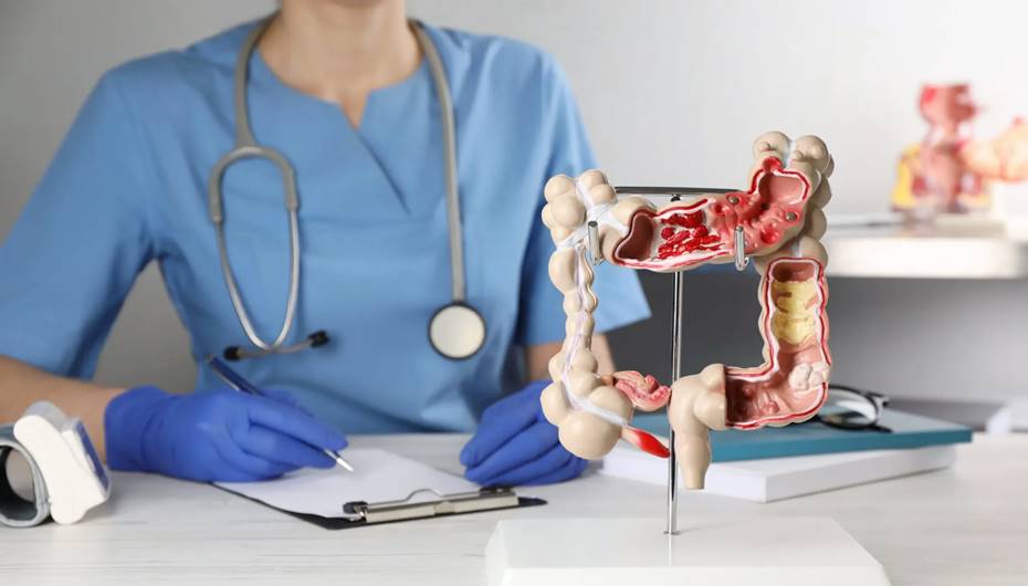 Kolon kanserinde yaş sınırı düşüyor!