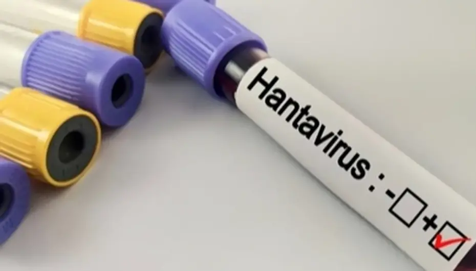 Hantavirüs salgına dönüşür mü? Kapalı alan temizliğinde büyük risk